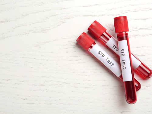 Three vials labeled “STD Test” lie on a white table, ready for laboratory diagnostic analysis