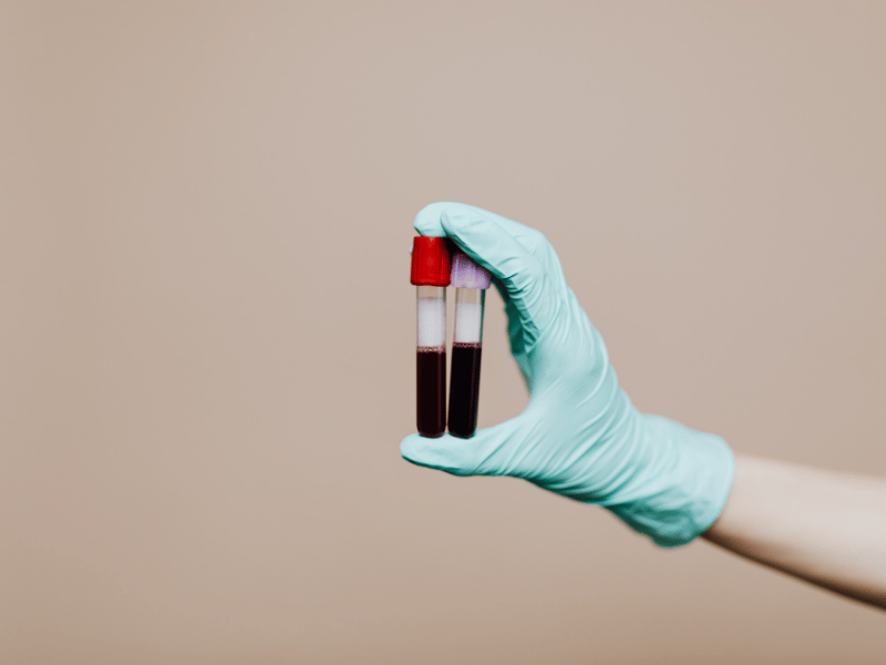 A gloved hand holds two blood sample tubes, showing separated blood components for testing